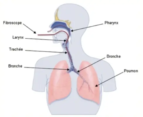 Fibroscopie bronchique